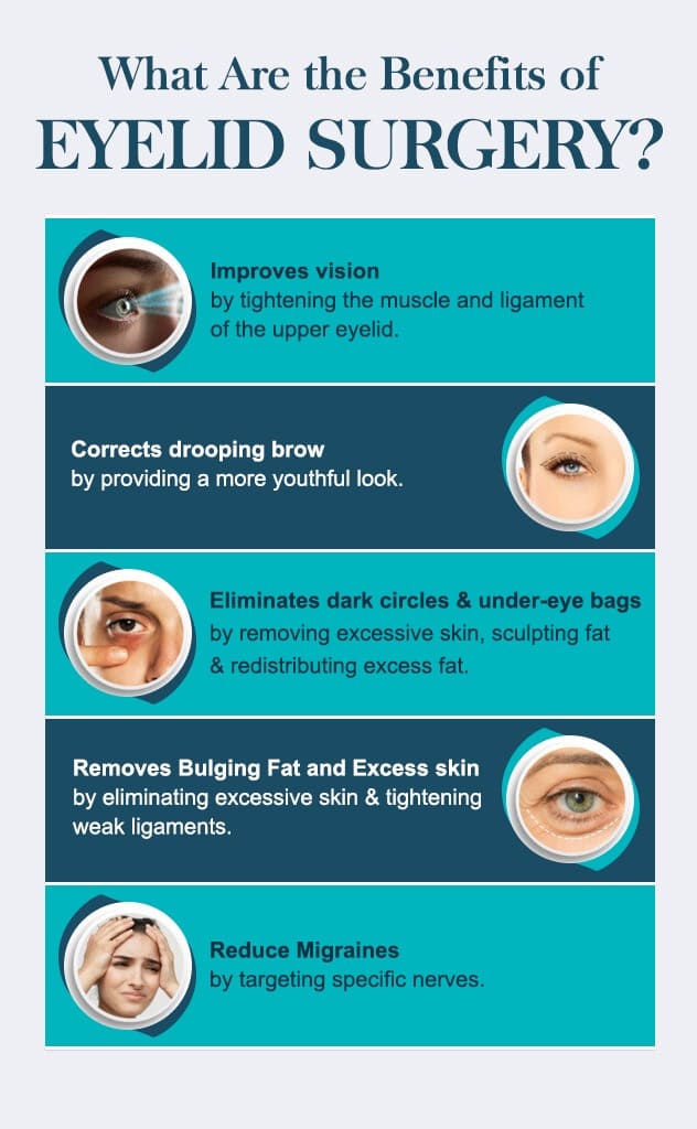benefits-of-eyelid-surgery