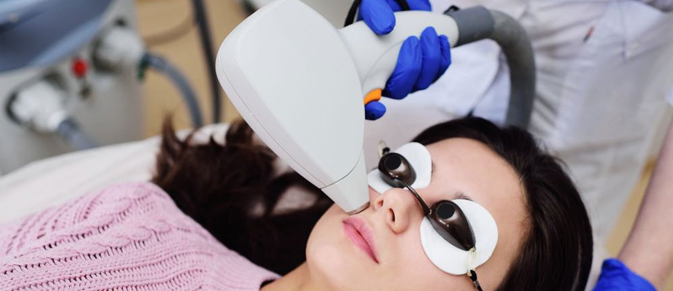 laser-treatments